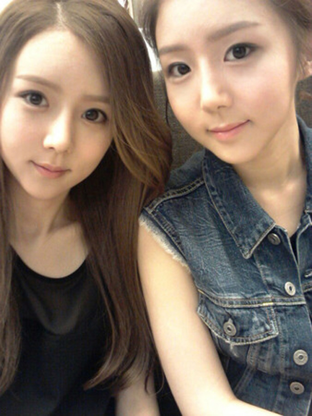 korean twin sisters plastic surgery