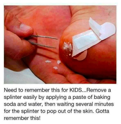 how-to-remove-a-spliinter-with-baking-soda-and-water-life-hack