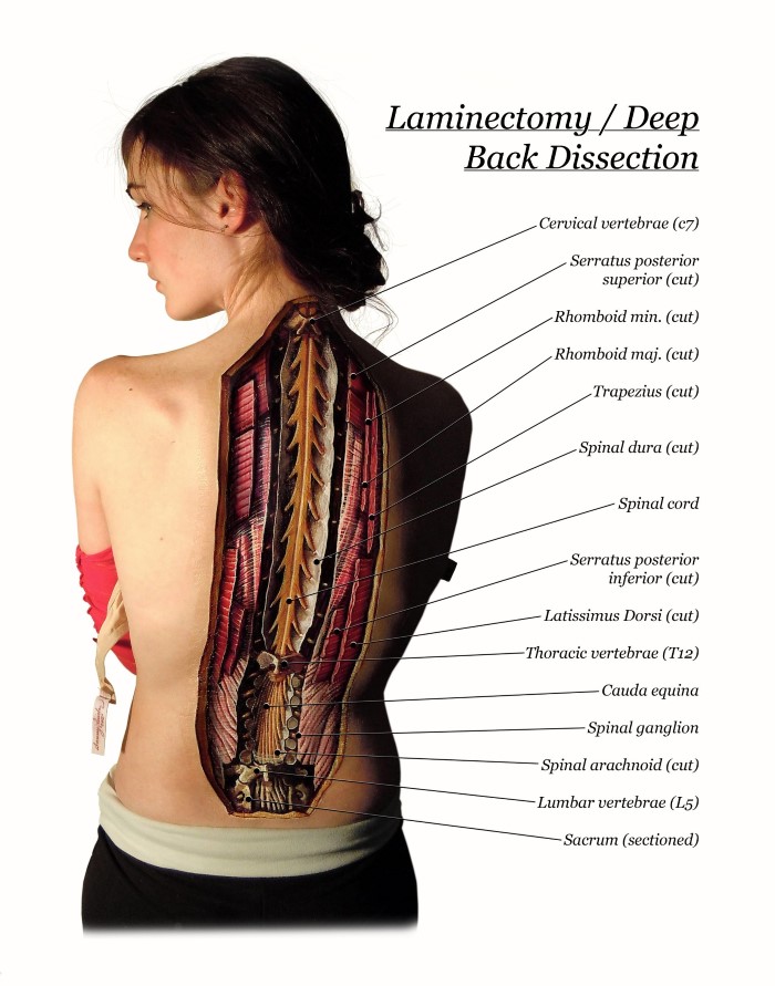 Spinal Anatomy Art
