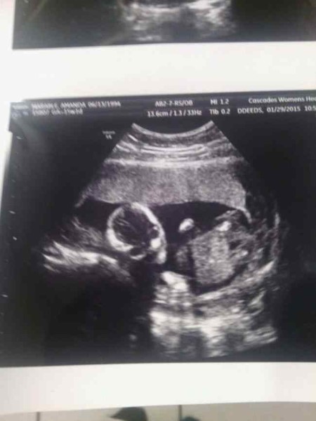 Baby Scans