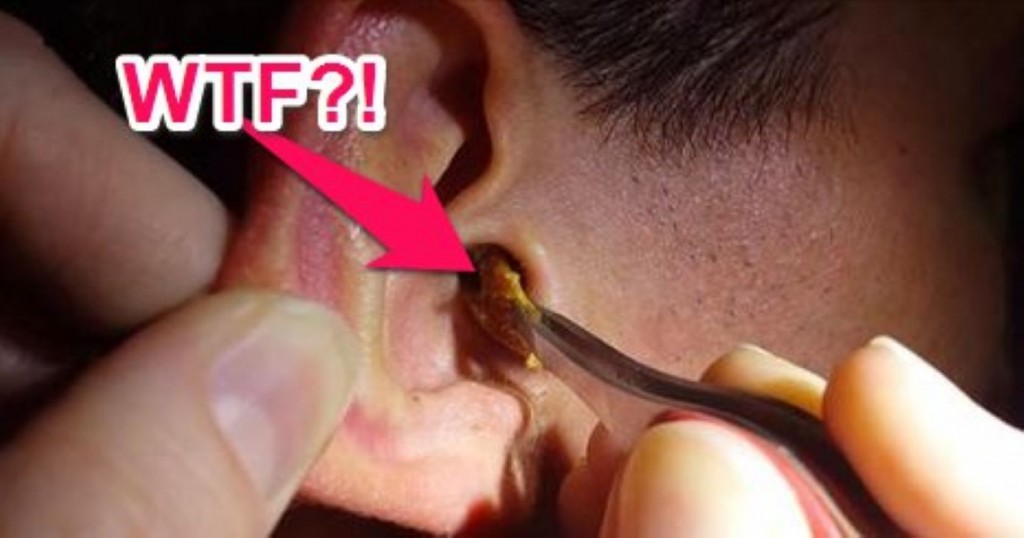 how to get earwax out of your ear at home